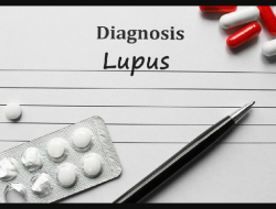 Apa Itu Lupus Nefritis yang Diidap Shena Malsiana Sebelum Meninggal?